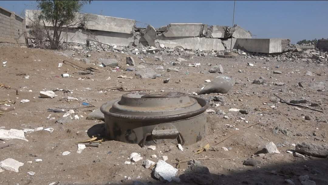 کودک ۱۰ ساله سنندجی بر اثر انفجار مین قطع عضو شد