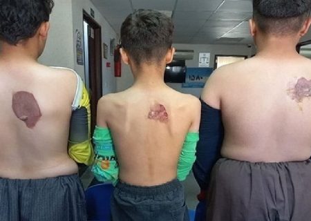 تشکیل پرونده قضایی برای خیاطی که شاگردانش را با اتو داغ کرد