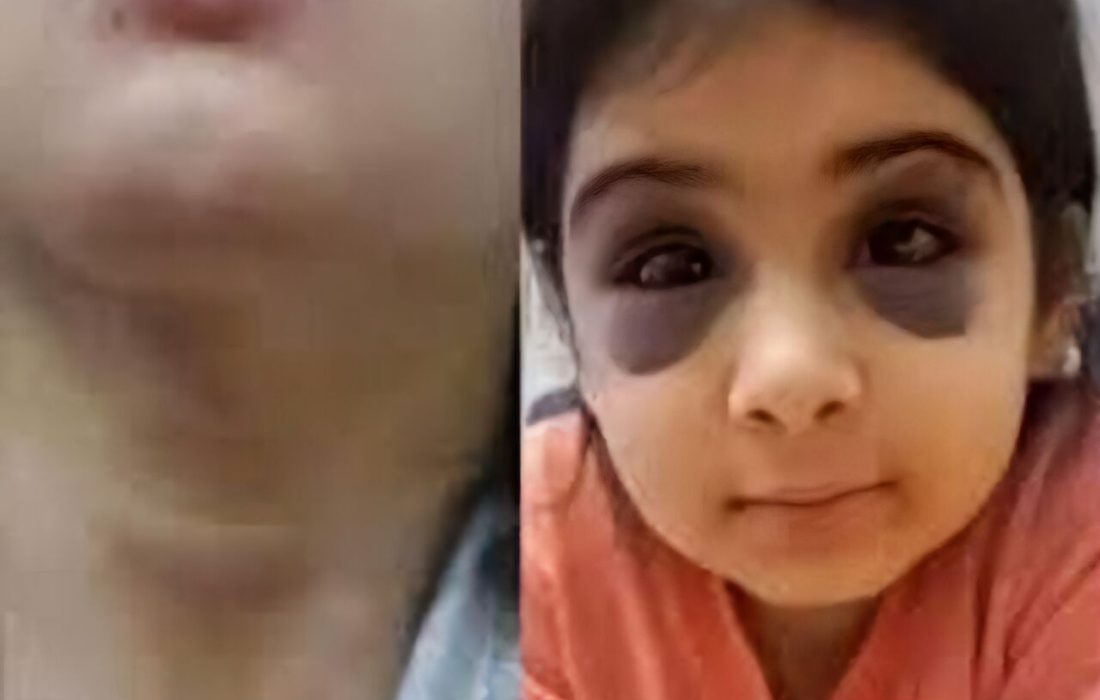 دستور رئیس کل دادگستری کردستان برای رسیدگی به پرونده کودک آزاری در سنندج